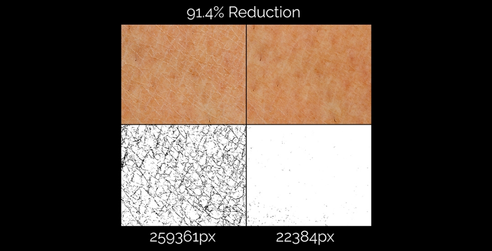 Recommended Remedies for How to Get Smooth Skin - Validated Claim Support