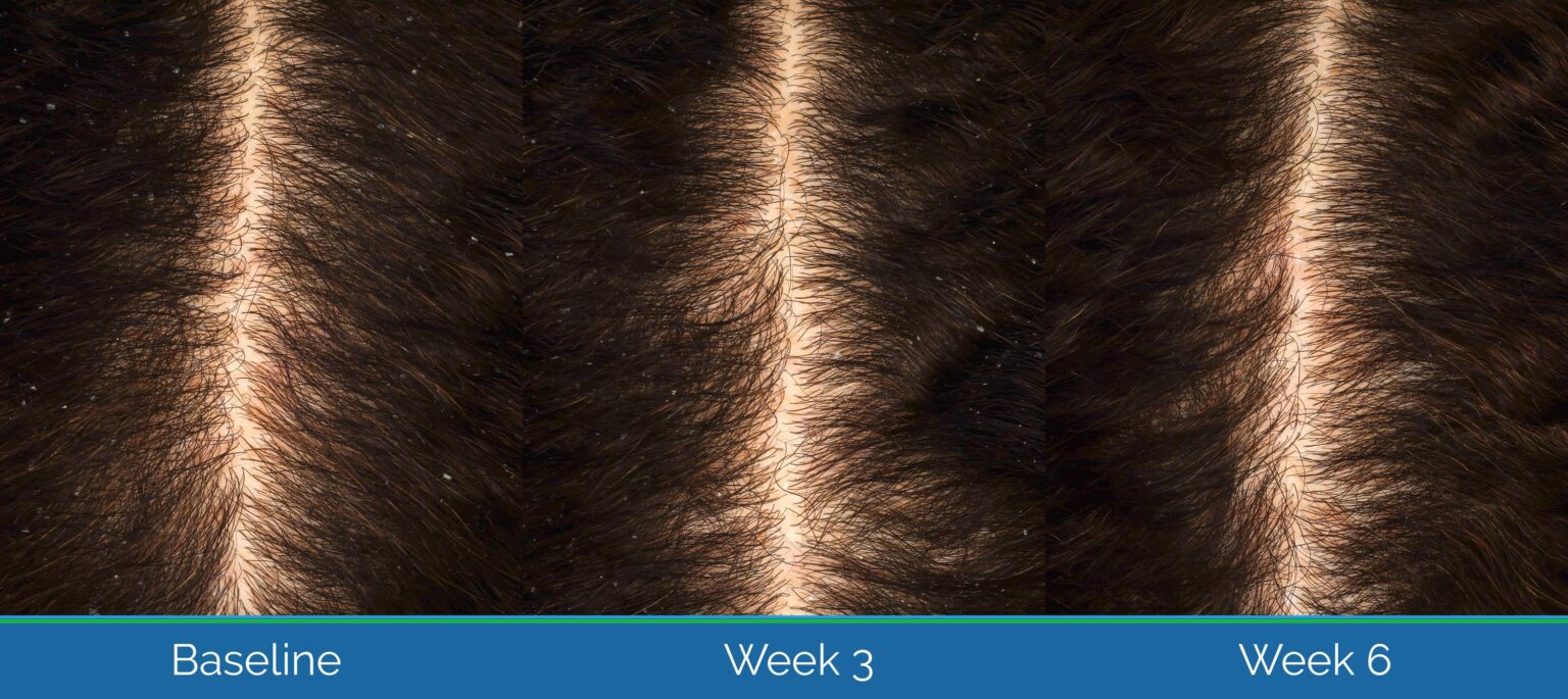 Haircare Product Efficacy - Validated Claim Support