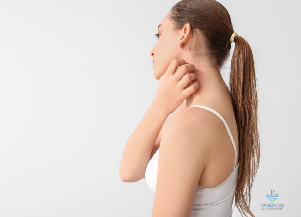 Eczema - pic 7 1025 x 740 px 1