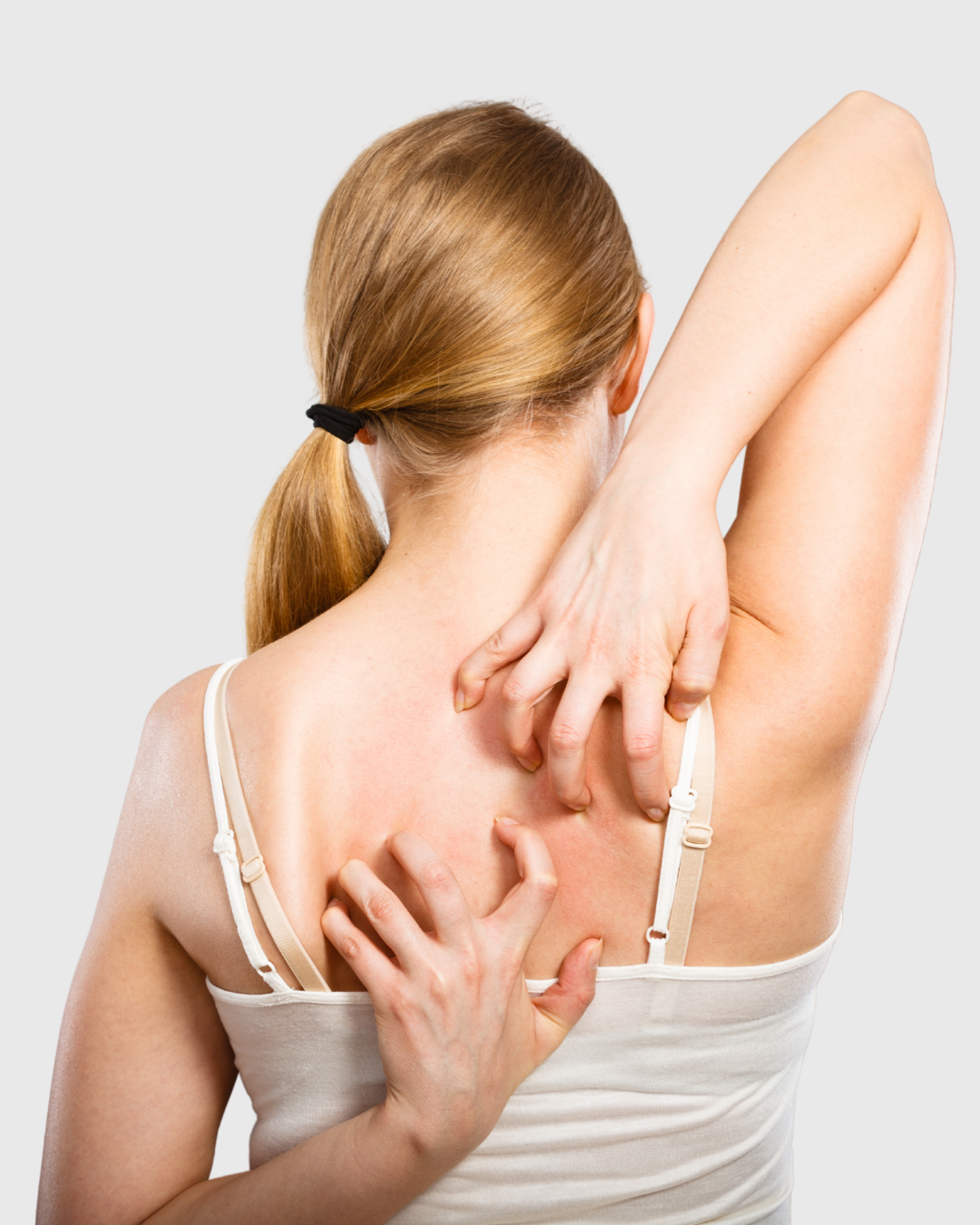 Eczema pic 8 1080 x 1350 px