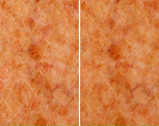 Moisturization Testing case study, baseline compared with result