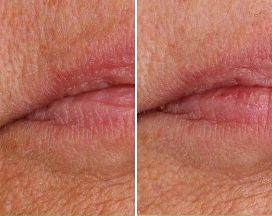 Cosmetic Durability case study, baseline compared with result