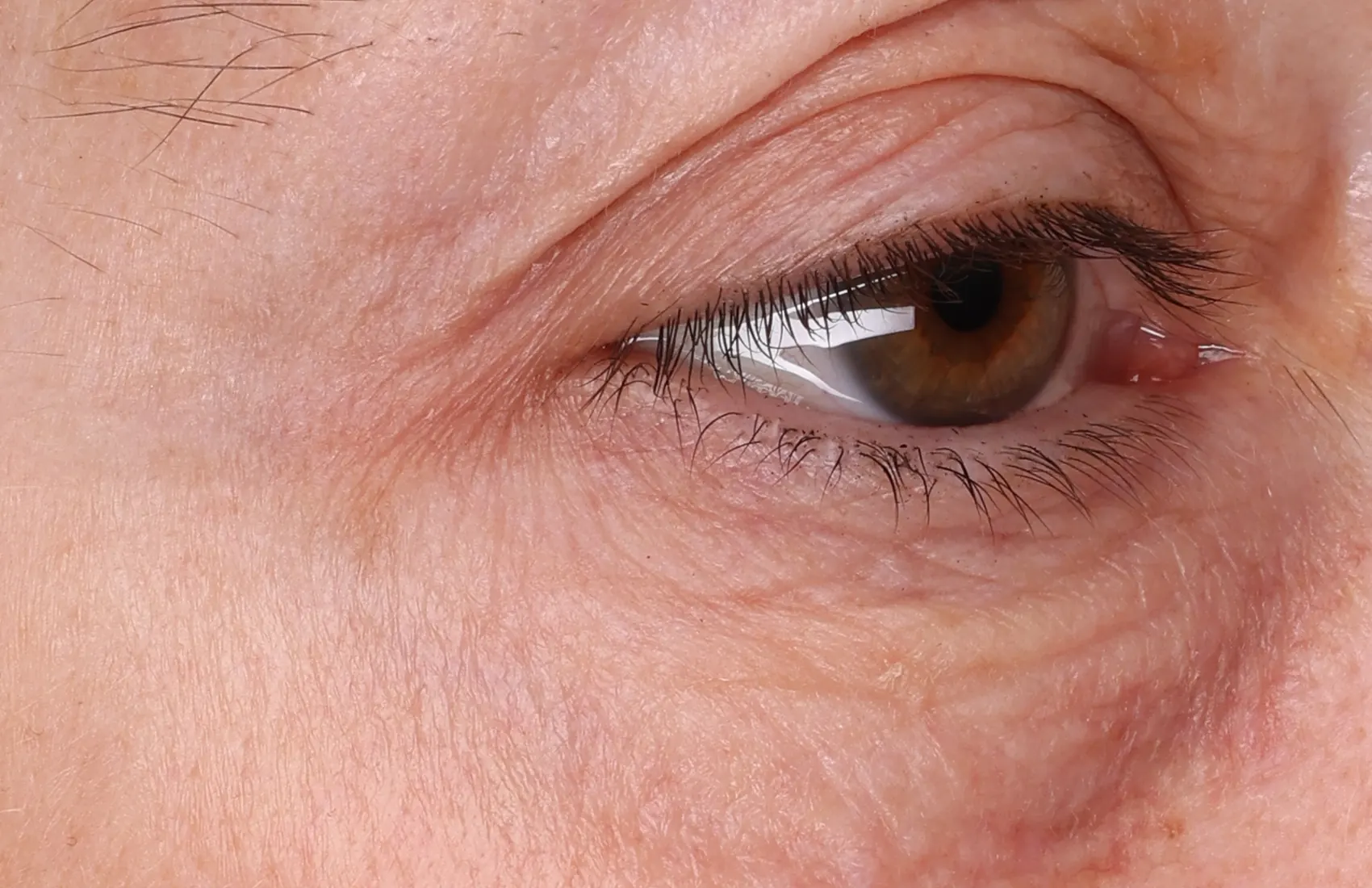 Close-up of crow's feet and under-eye at T1, full resolution