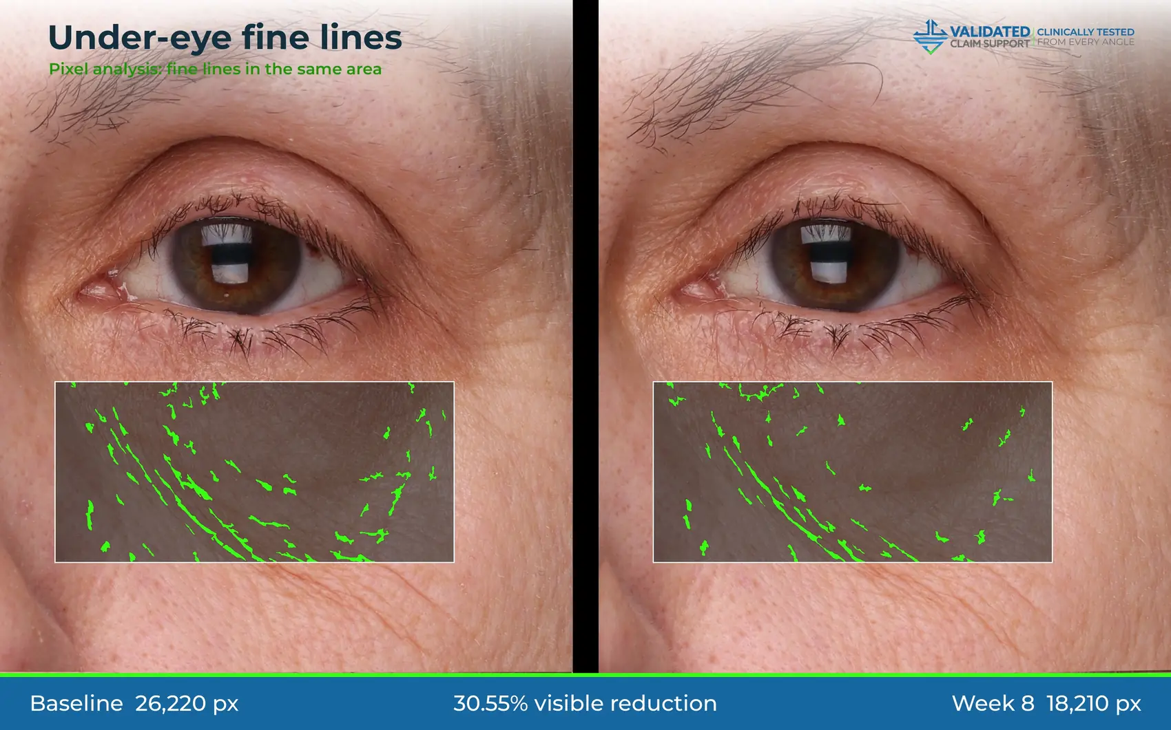 Deck-style graphic: under-eye fine lines, 30.55% visible reduction