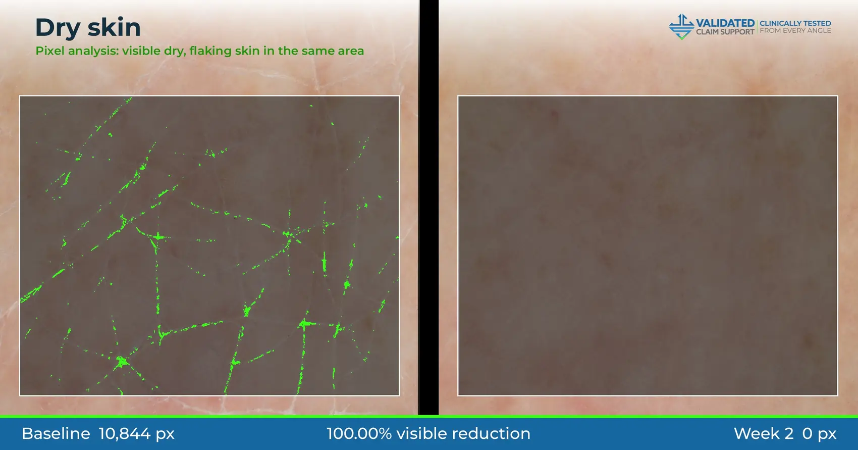 Deck-style graphic: dry skin, 100% visible reduction