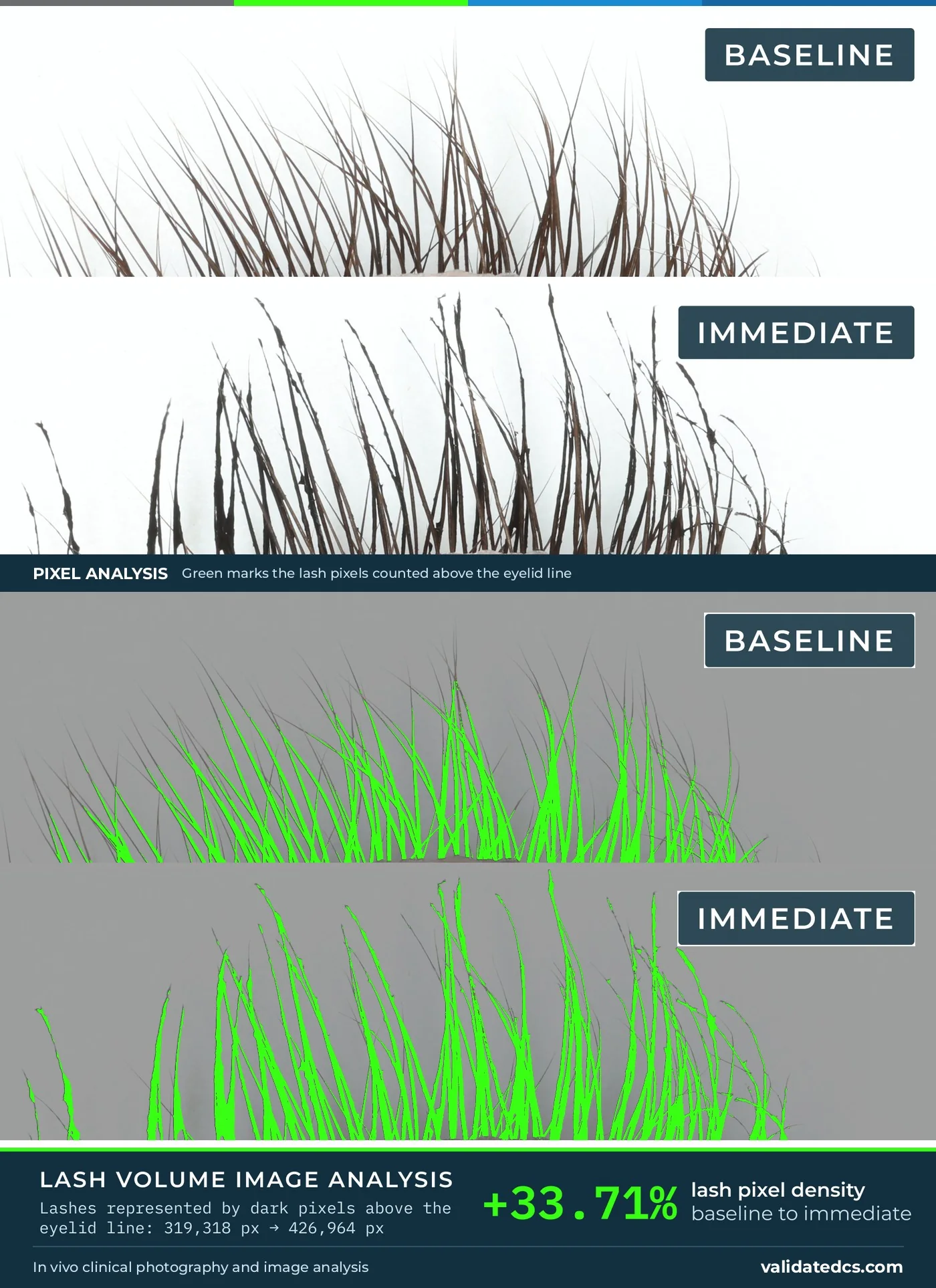 Case study graphic, Lash volume: +33.71% lash pixel density, baseline to immediate, print layout with pixel analysis