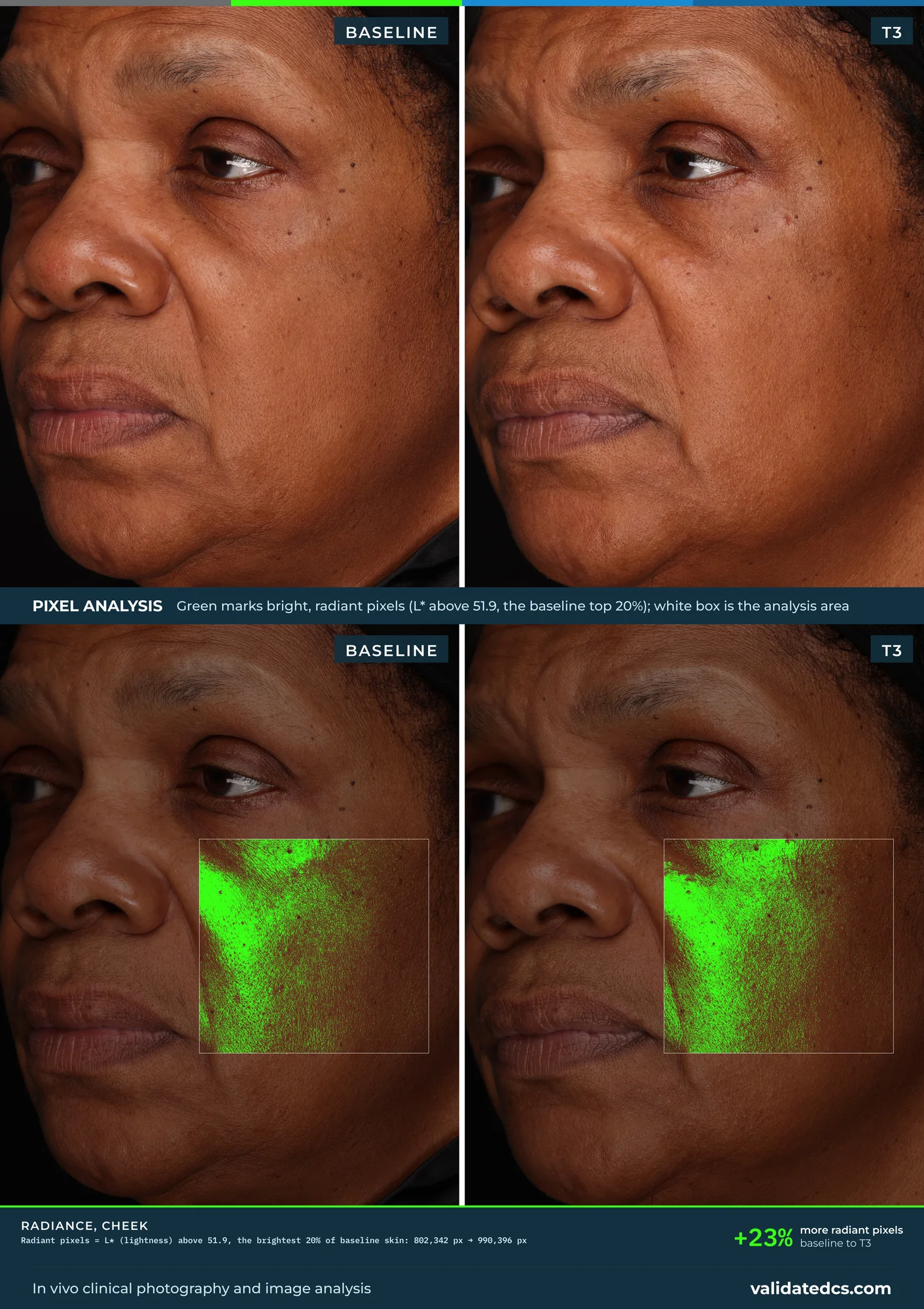 Case study graphic, Radiance, cheek: +23% more radiant pixels, baseline to T3, print layout with pixel analysis